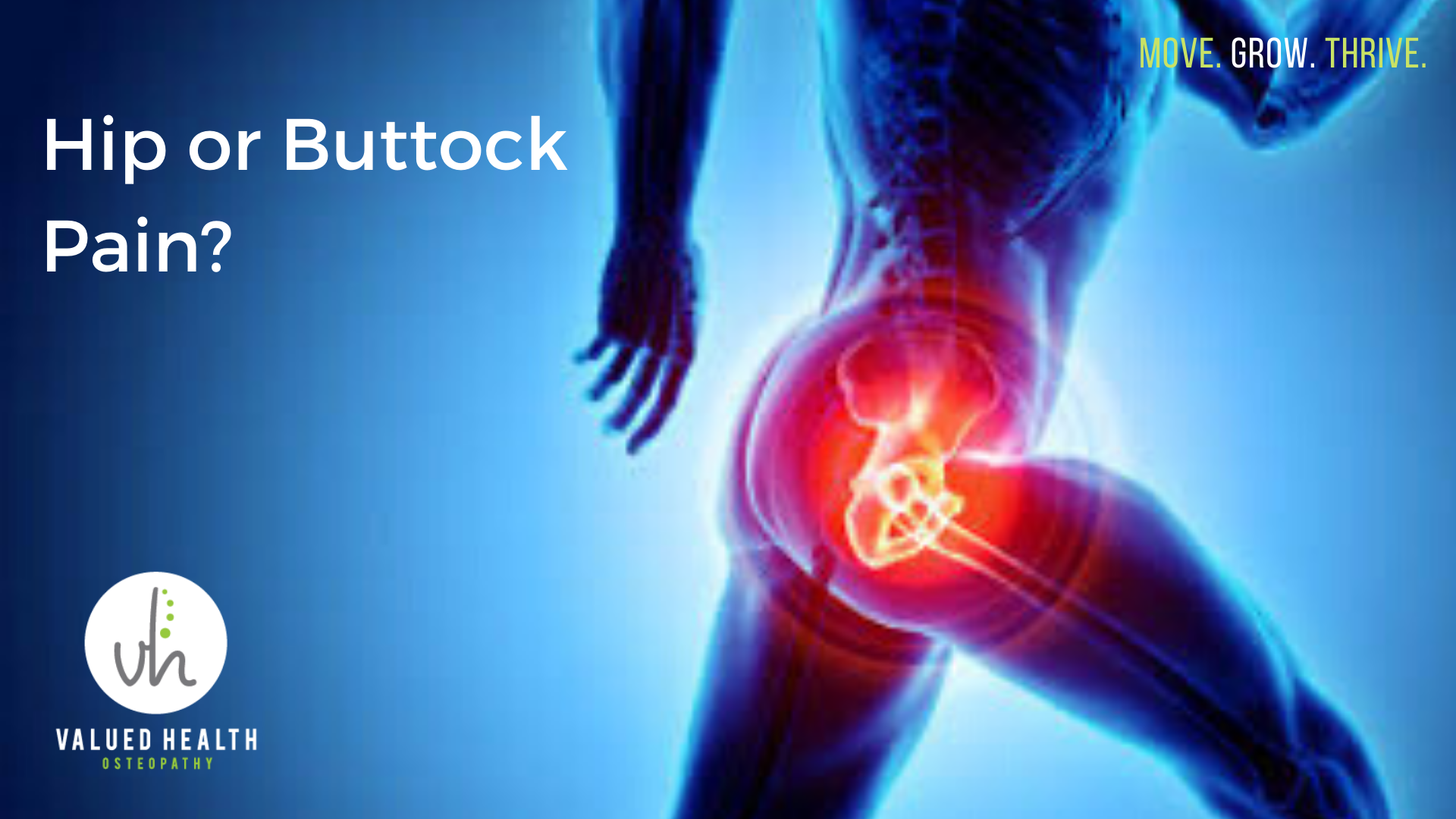 Hip Or Buttock Pain Trochanteric Bursitis Vlaued Health Osteopathy