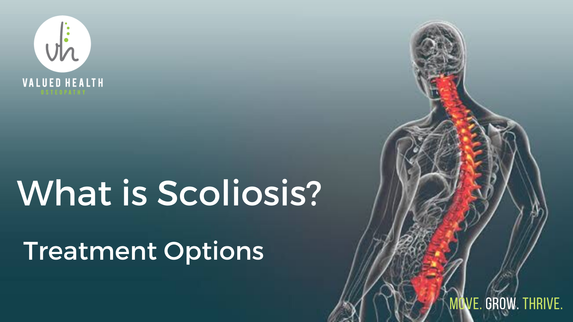 scoliosis treatment options