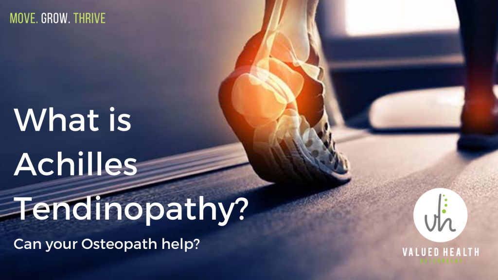 What is Achilles Tendinopathy? Ankle pain Osteo, Osteo Bentleigh, heel pain Osteo, heel pain physio, ankle pain physio, Osteopath Bentleigh