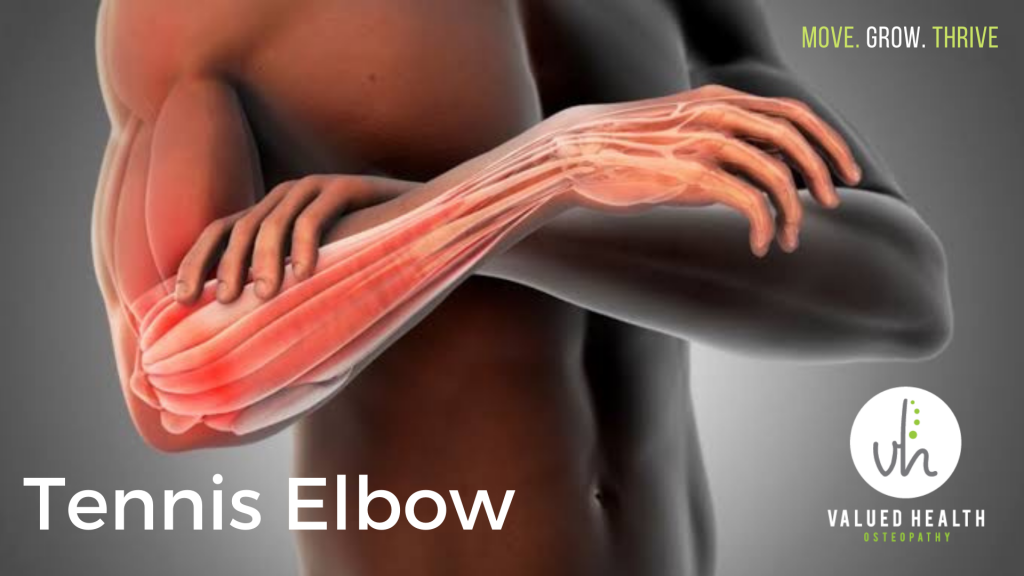 Tennis Elbow, Elbow pain, Lateral epicondylitis, Golfers elbow, Golfer's elbow, lateral elbow pain, medial elbow pain, wrist pain, Osteopath Bentleigh, Osteopath Bentleigh East, Osteopath east bentleigh, Osteopath Ormond, Osteopath Moorabbin, Osteopath Brighton, Osteopath Clayton, Osteopath Oakleigh, Osteopath McKinnon, Osteopath centre Road, Osteopath bayside, Osteopath Carnegie