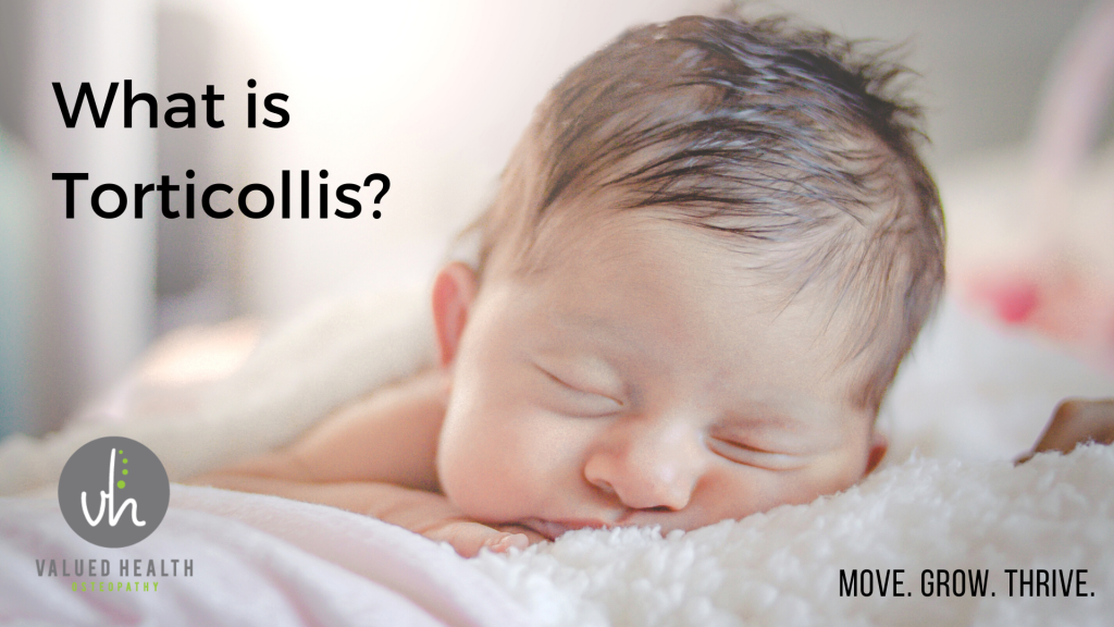 What is Torticollis? Torticollis, Torticollis and Osteopath, Torticollis and Physiotherapy, Torticollis and infants, Torticollis and babies, Torticollis and Children