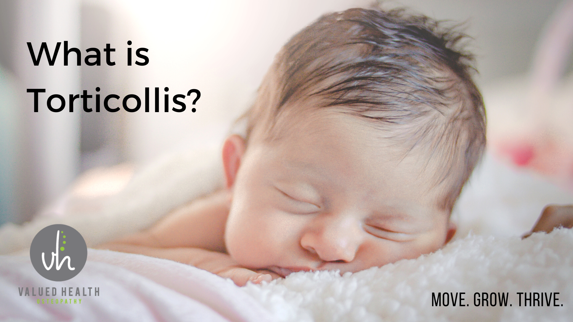 Torticollis Information