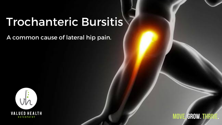 Trochanteric Bursitis | A Common Cause Of Lateral Hip Pain.